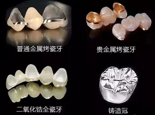 【身邊的先進(jìn)陶瓷】義齒與氧化鋯陶瓷